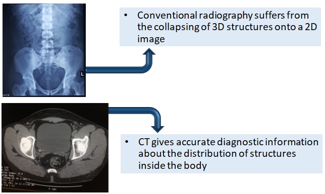 CT Vs. Conventional Radiography